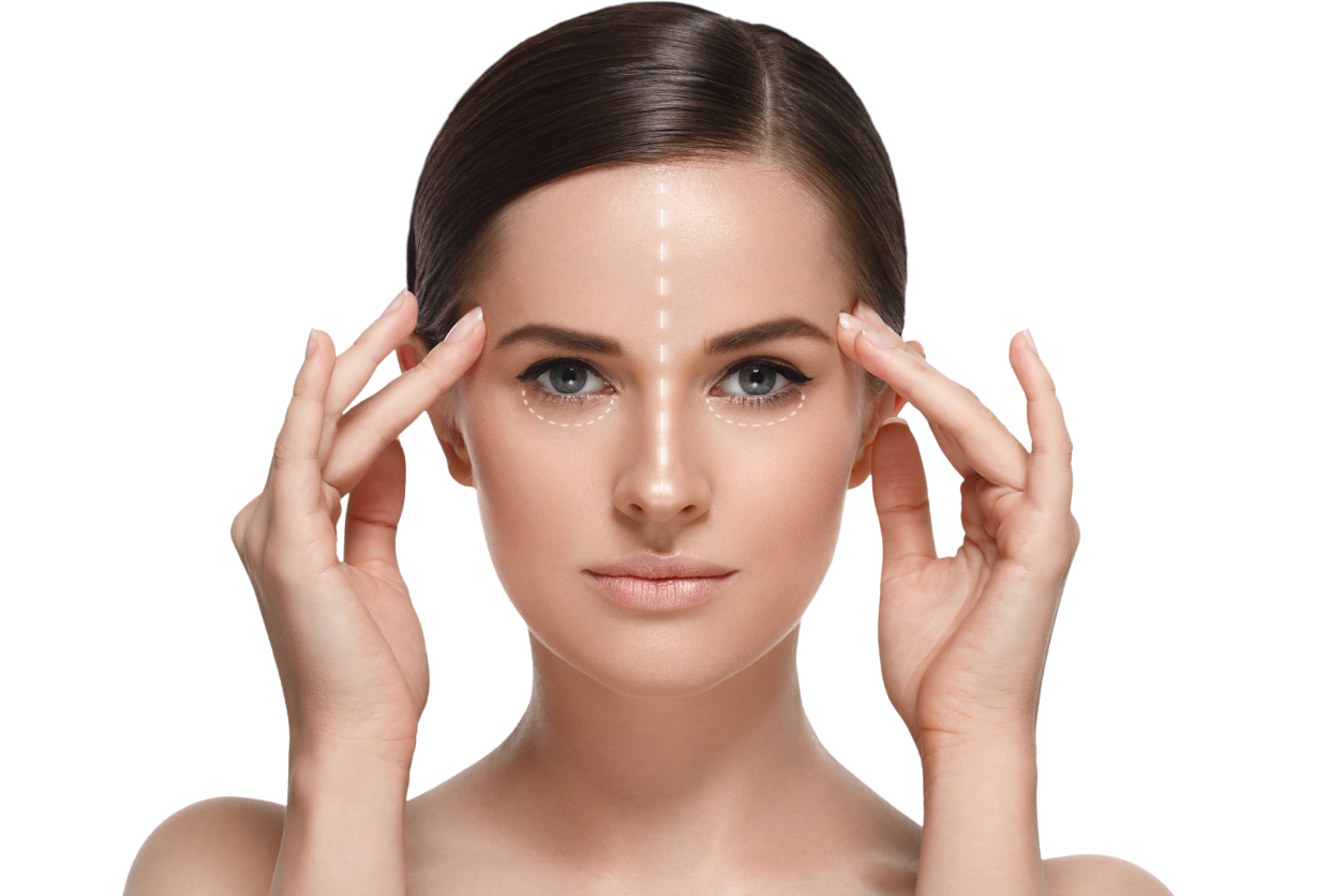 Facelift surgical technique illustration