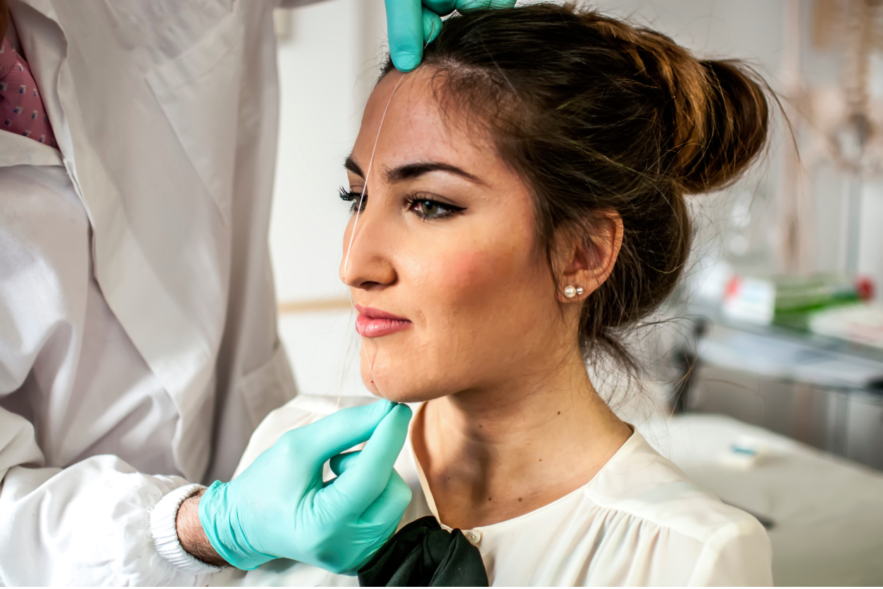 Mentoplasty chin surgery illustration