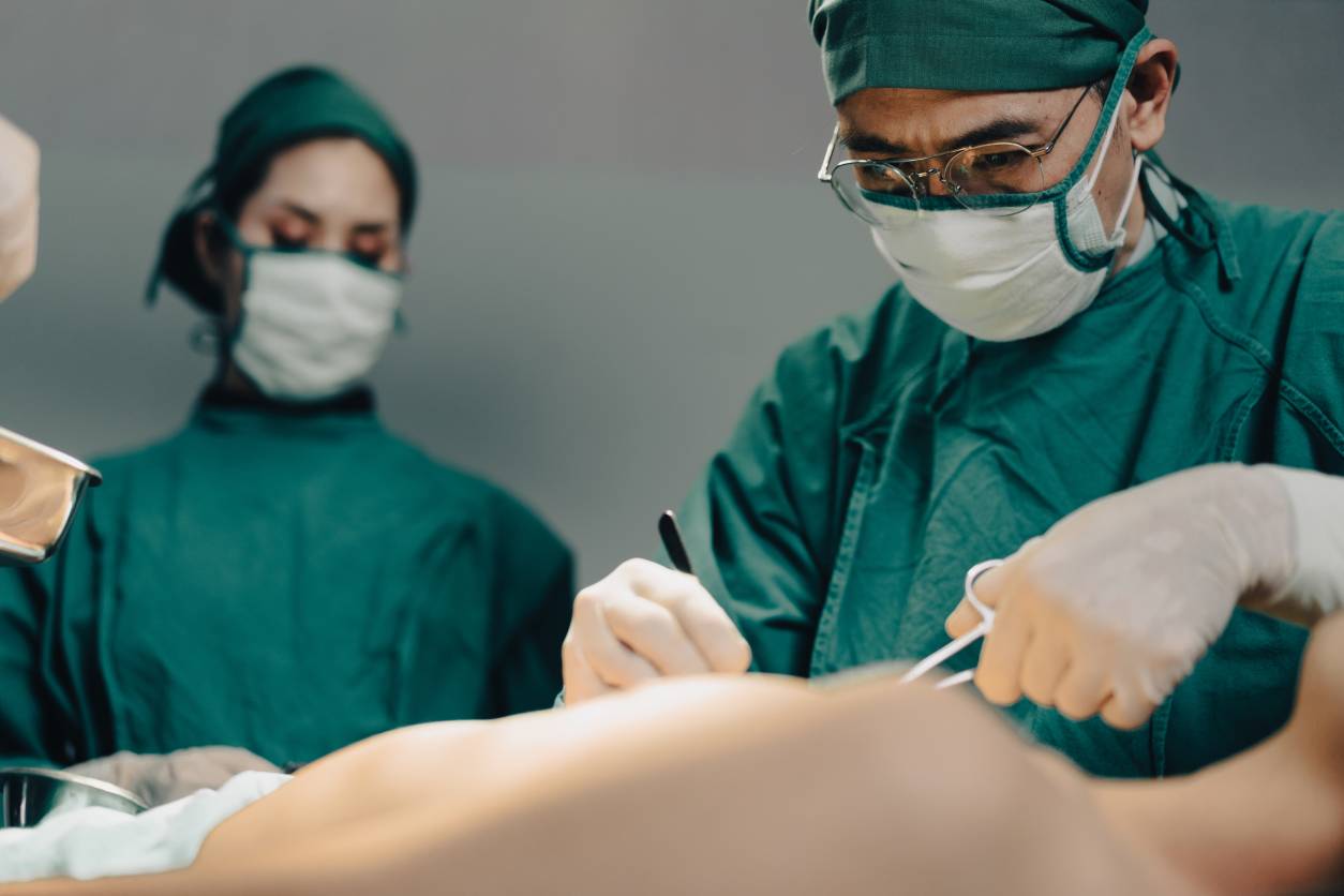 Parotidectomy surgical procedure illustration